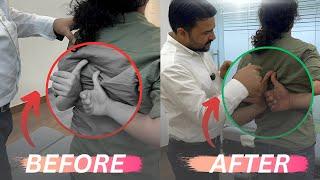 Shoulder blade pain treatment by dr harish grover