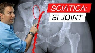 Sciatica and SI Joint Dysfunction: The Surprising Connection