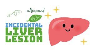 Liver hemangioma - the most commonly encountered incidental liver lesion on ultrasound