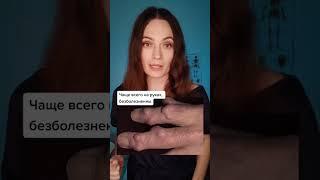 Образования на пальцах