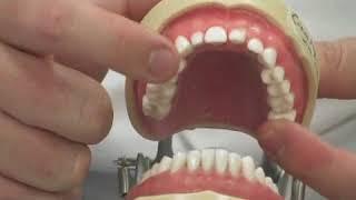 Dental Procedures Explained