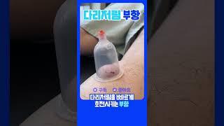 다리 저릴 때 한방병원에서는 어떤 치료를? #shorts