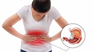 #8 Tại sao càng uống thuốc dạ dày càng làm dạ dày kém đi