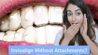 Can I Have Invisalign Without Attachments?