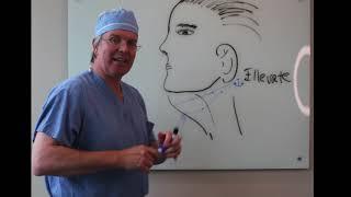 How Dr. Claytor Gives You a YOUNGER Looking Neck! | Necklift, SmartLipo, MyEllevate