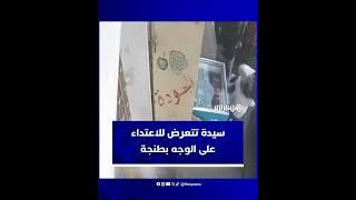 مضطرب عقليا يعتدي على سيدة بأداة حادة على مستوى الوجه بمنطقة أشناد بطنجة