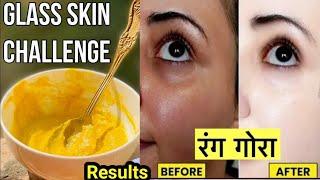 दही बेसन से चेहरा पर खुजली और redness का रामबाण नुस्खा 100%Remove pigmentation, itching,sun tan 