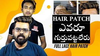 ఈ Hair Patch ను ఎవరు గుర్తుపట్టలేరు || Full Lace Hair Patch In Hair Replacement process