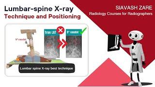 Lumbar-spine X-ray technique and protocol (for Radiographers)