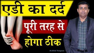 एडी का दर्द पूरी तरह से होगा ठीक I Heel pain क्यों होता है? | Edi me dard ka ilaj in Hindi