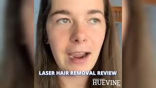 Laser Hair Removal Review | HueVine