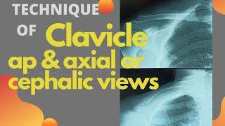 Technique of x ray clavicle views (Ep-57) | Clavicle AP, Axial or AP Cephalic view