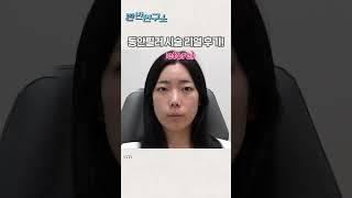 [반반연구소] 동안필러 효과가 이정도라고? 실제 리얼 모델 후기 대공개!