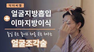 얼굴지방흡입과 이마지방이식 동시 시술 후기 Ep.1