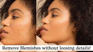 Flawless Skin Retouching in Photoshop: Remove Blemishes without Losing Details