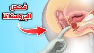 شاهد كيف يتم فحص البروستاتا للرجال_Prostate enlargement and rectal examination