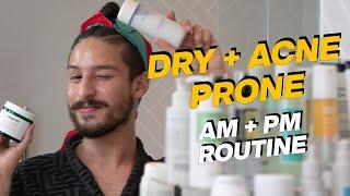 Dry + Acne-Prone Skin AM/PM Routine $-$$$ (Great For Teen Acne!) | Ramon Recommended