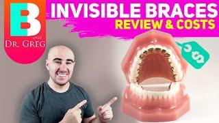 Invisible Braces and Braces Cost