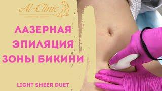  Глубокое бикини | ЛАЗЕРНАЯ ЭПИЛЯЦИЯ ЗОНЫ БИКИНИ | РАЗРУШАЕМ МИФЫ |ИЗБАВЛЯЕМСЯ ОТ ВОЛОС ЗА 7 МИНУТ!