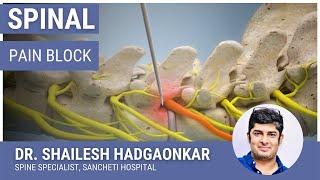 स्पायनल पेन ब्लॉक - जाणिये आखिर क्या होता है? स्पाईन इंजेक्शन | SPINE Pain Block Injection