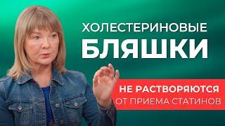 Почему врачи назначают статины? Правда, что от повышенного холестерина появляются бляшки в сосудах?