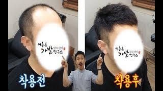 30대 남자가발 후기 (탈모 치료 받으시다가 실패 후 가발 착용)