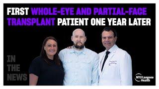 One Year Later: First Whole-Eye and Partial-Face Transplant Patient Makes Remarkable Progress