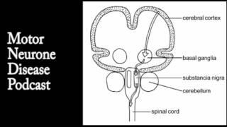 Motor Neurone Disease (ALS or Leu Gehrig's)