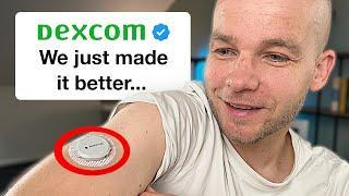 Dexcom G7 Major Upgrades Revealed – Don’t Miss Out!