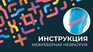 Kinexib - тейпирование межреберной невралгии