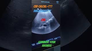comment your answer?
