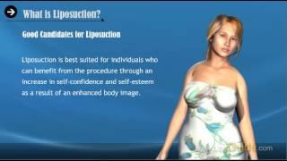 Liposuction Surgery