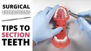 SURGICAL EXTRACTION SECTIONING TIPS | OnlineExodontia.com