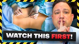 Workers Comp Surgery Secrets No One Will Tell You!