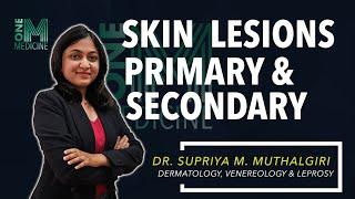 Chapter 5A | Lesions of The Skin | Dermatology | OneMedicine