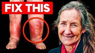 15 Years of Swollen Legs & Feet Gone in Minutes! Barbara O'Neill's HIDDEN Discovery