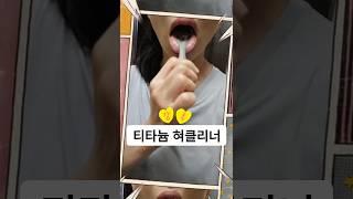 Clear white tongue with titanium tongue cleaner! Honey tip to get rid of bad breath #shorts