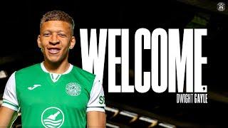 Dwight Gayle's First Hibs TV Interview | Welcome To Hibernian FC