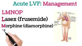 Acute Left Ventricle Failure || LVF || Management || Medical Mnemonics