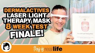 Dermalactives Laser Light Therapy Mask 8 Week Test: FINALE - THIS IS REAL LIFE