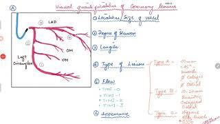 Coronary Angiogram. Visual quantification of coronary lesions.