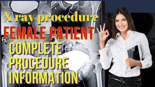 x ray mcu procedure | mcu female procedure | mcu x ray procedure in hindi | MCU radiology #trending