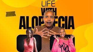 Life with Alopecia || Big Channel Announcement