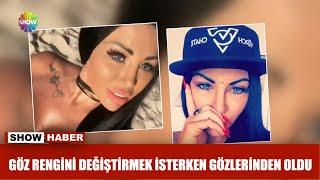 Göz rengini değiştirmek isterken gözlerinden oldu