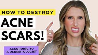 Acne Scar Treatments That Work! | Dr. Sam Ellis