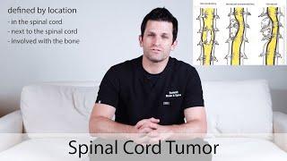 Spinal Cord Tumor