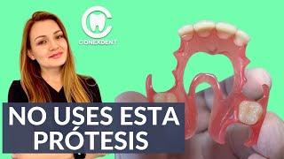 #prótesisdental #odontologia  ¡¡ No uses esta prótesis dental !! 