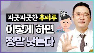 후비루 치료, 포기하지 마세요! 후비루 낫는 5가지 치료 핵심 공개