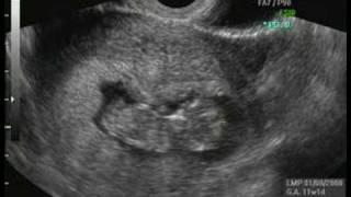 Our Baby