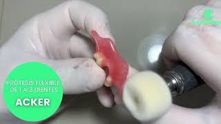 PRÓTESIS DENTAL flexible de dos dientes  tipo Acker